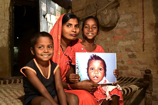 On World Cleft Awareness Day, Smile Train India Marks 800,000+ Free Surgeries 