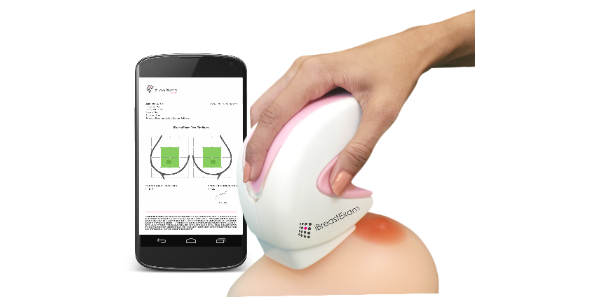 iBreastExam